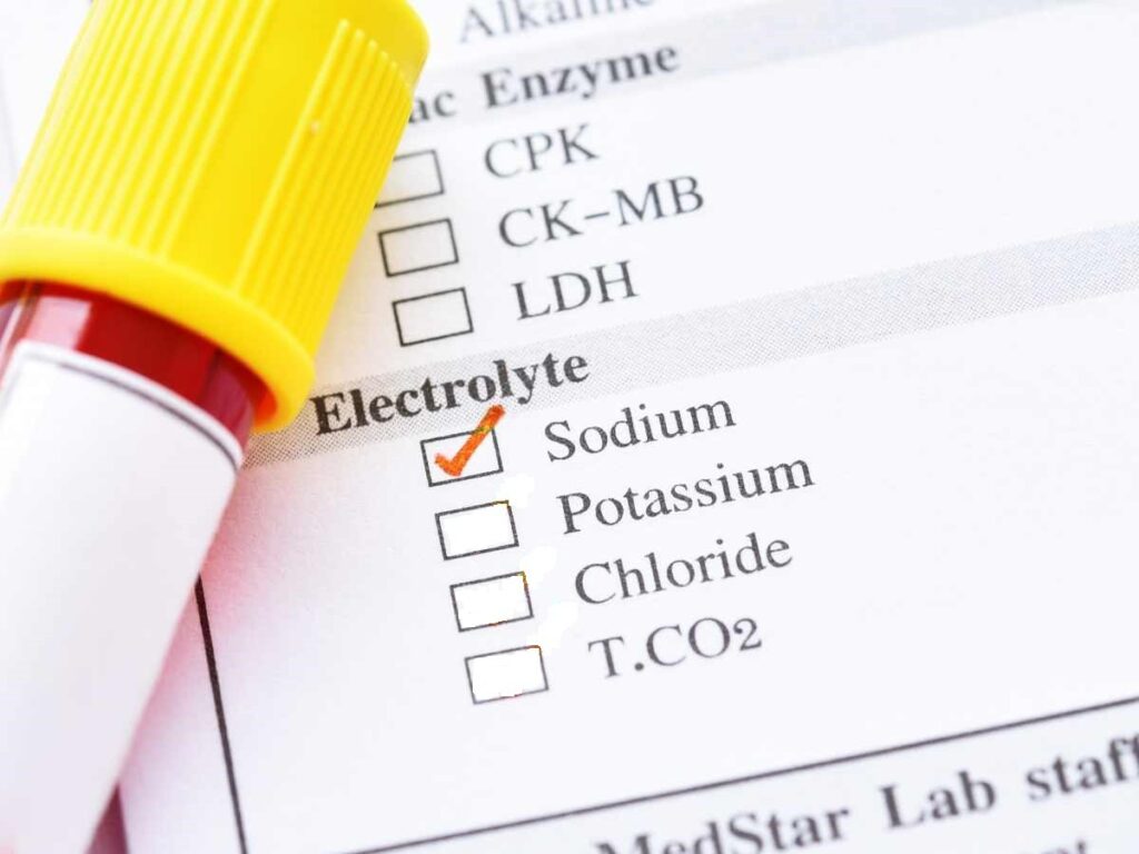 sodium test of the lab