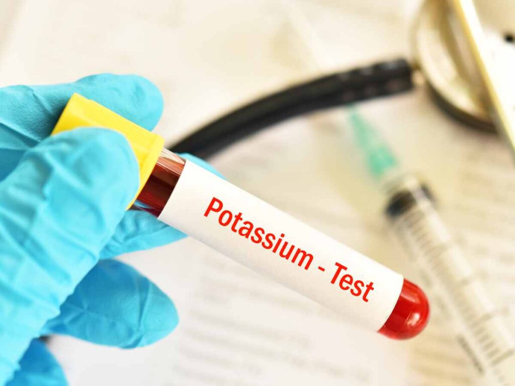 lab potassium test